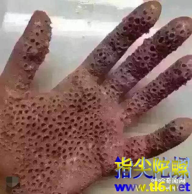 芝麻女孩和玉米男孩，胆小密集恐惧症患者勿进（令人头皮发麻）